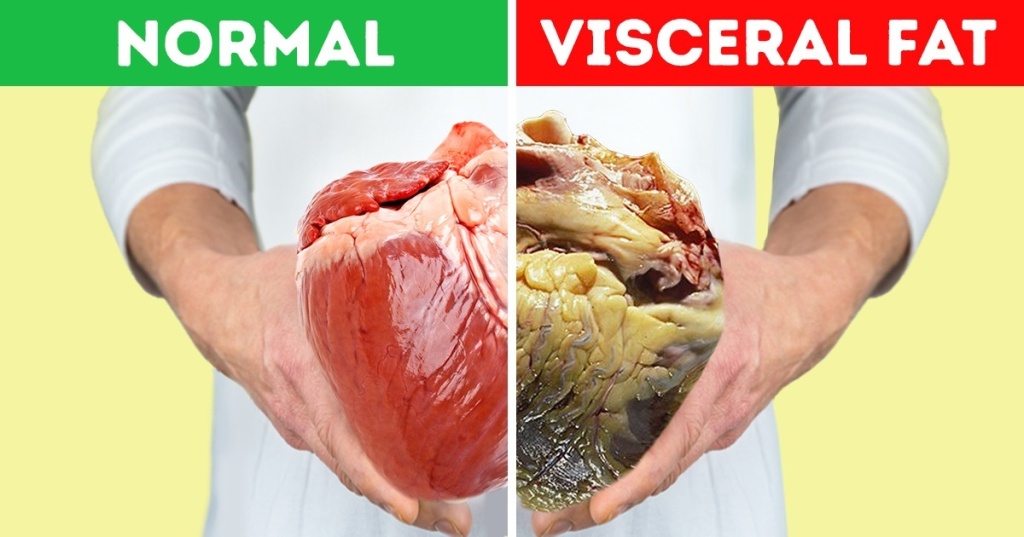 Visceral Fat: What Is It and How to Lose It – BIO